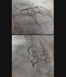 Emergent Cardiac case Emergent Cardiac case